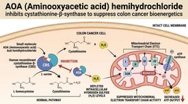AOA (Aminooxyacetic acid) hemihydrochloride inhibits cystathionine-β-synthase to suppress colon cancer bioenergetics