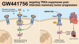 GW441756 targeting TRKA suppresses post-infarction mammary tumor progression