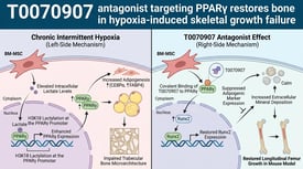 T0070907 antagonist targeting PPARγ restores bone formation in hypoxia-induced skeletal growth failure