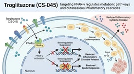Troglitazone (CS-045) targeting PPAR-γ regulates metabolic pathways and cutaneous inflammatory cascades