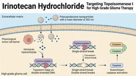 Irinotecan Hydrochloride Nanoparticles Targeting Topoisomerase I for High-Grade Glioma Therapy