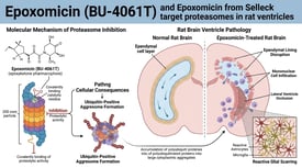 Epoxomicin (BU-4061T) and Epoxomicin from Selleck target proteasomes in rat ventricles